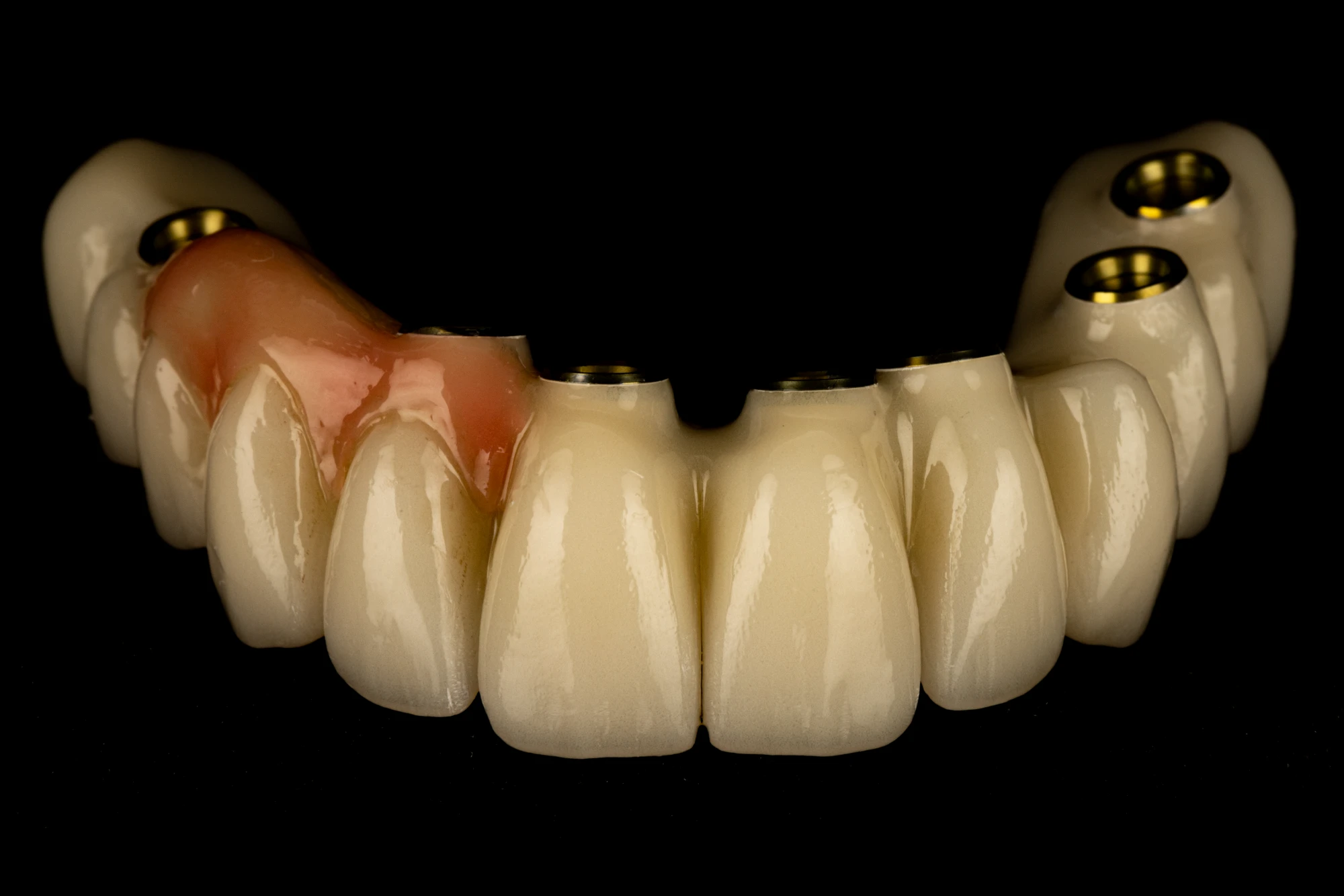 Full-arch screw-retained zirconia prosthesis on black